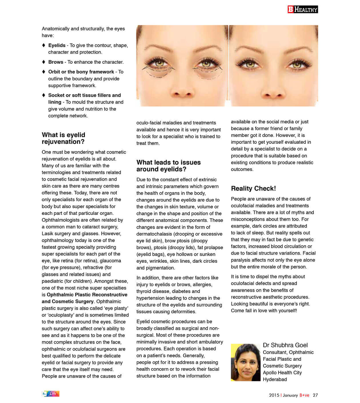 Cosmetic Rejuvenation Of Eyelids