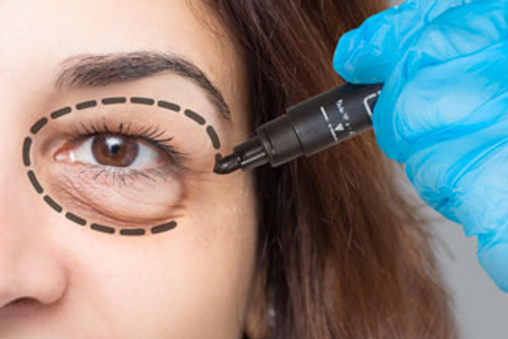 What is the difference between oculoplasty and plastic surgeons?