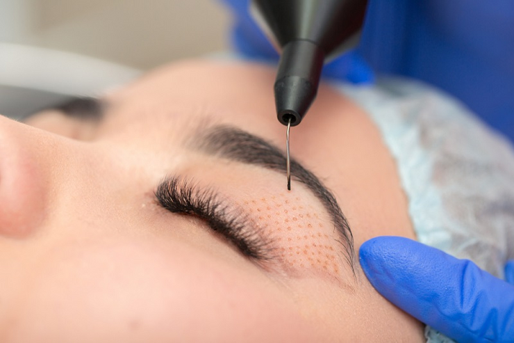 Do ophthalmologists perform plastic surgery?