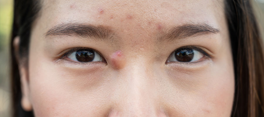 Face Lumps and Bumps: The Good the Bad and the Ugly But Mostly Harmless